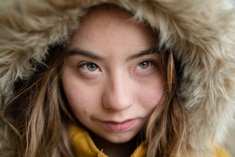 Close-up of young woman with Down syndrome weraing hood and looking at camera