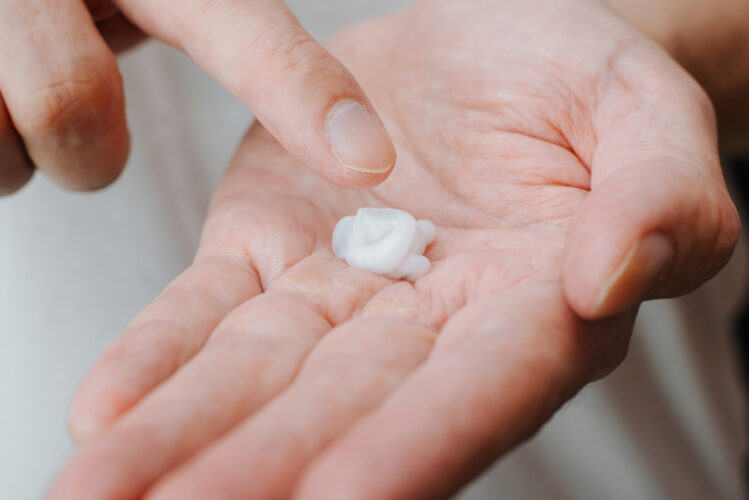 Skin care, dry hand treatment concept. Close-up hand applying moisturizing, softness cream